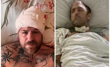 Bývalý zápasník MMA Štefan Bazsó z Košíc podstúpil operáciu lebky, úplne ho zmenila