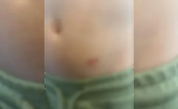 Mamička z Furče upozornila na chlapčeka, ktorý pohryzol jej syna, obyvateľov to okamžite rozdelilo na dva tábory