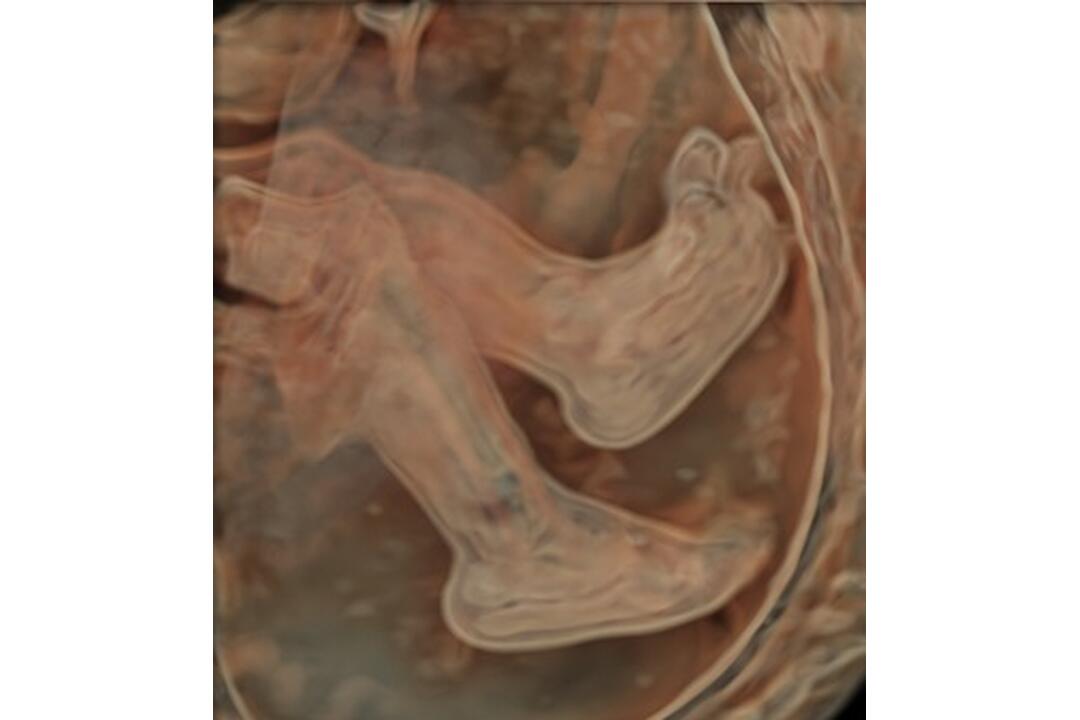 FOTO: Šačianska nemocnica predstavila najmodernejší ultrazvuk, foto 5