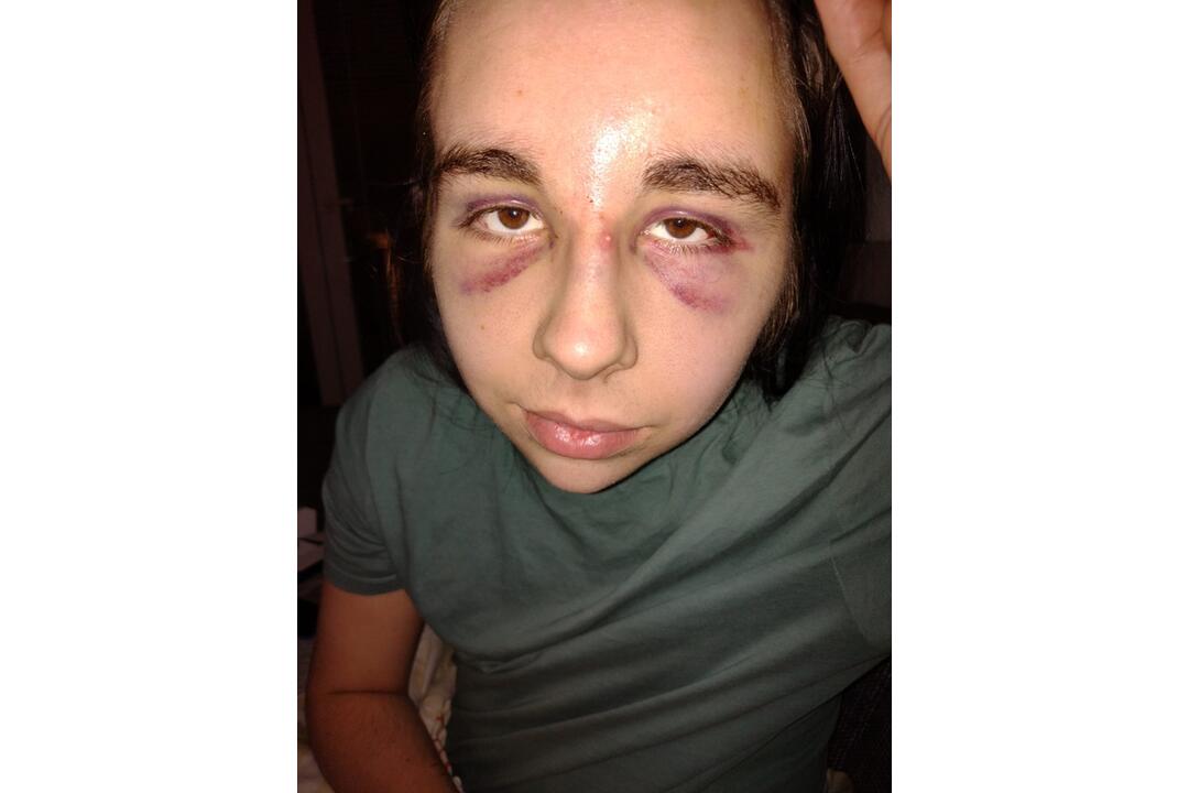 FOTO: Detský gang v Spišskej Novej Vsi napadol mladíka, foto 2