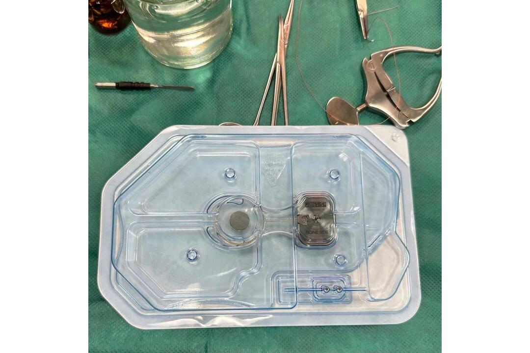 FOTO: Košickí otorinolaryngológovia zvládli operáciu revolučného sluchového implantátu, foto 2