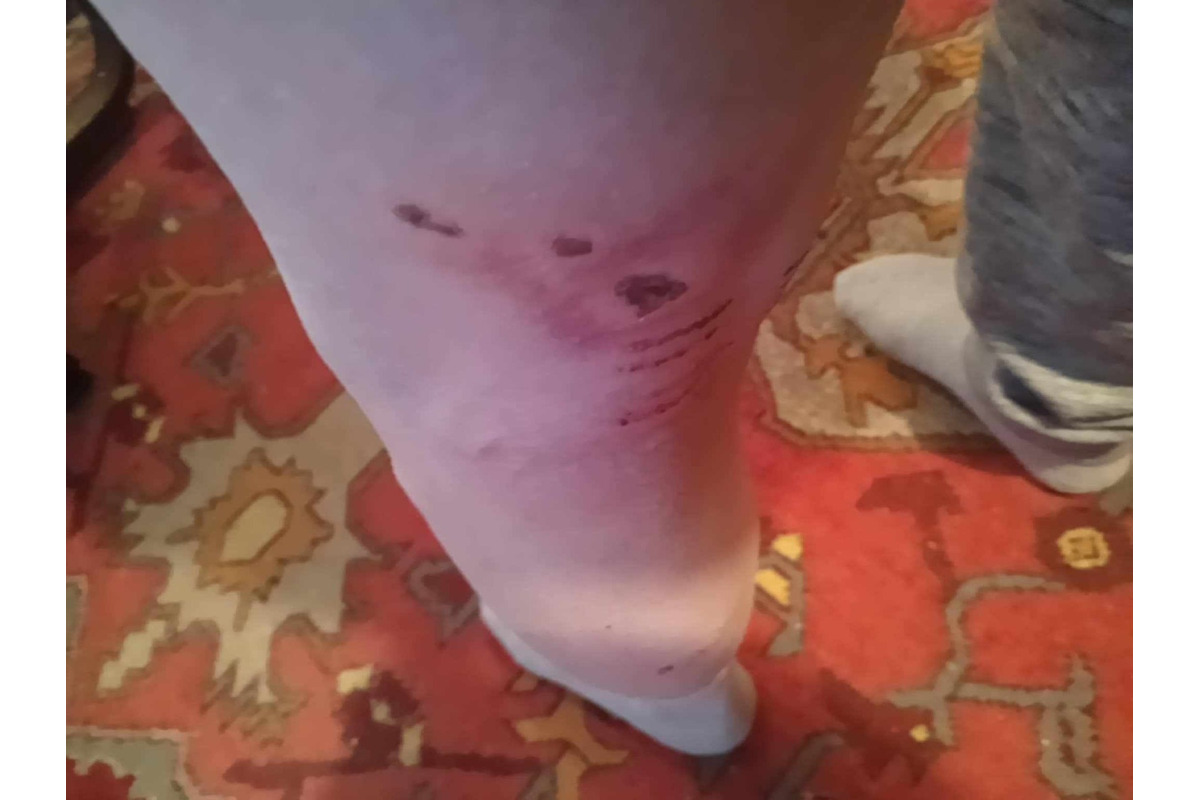 FOTO: Na seniora z Rožňavy zaútočil pes, foto 2