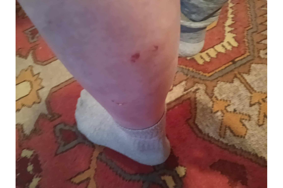 FOTO: Na seniora z Rožňavy zaútočil pes, foto 3