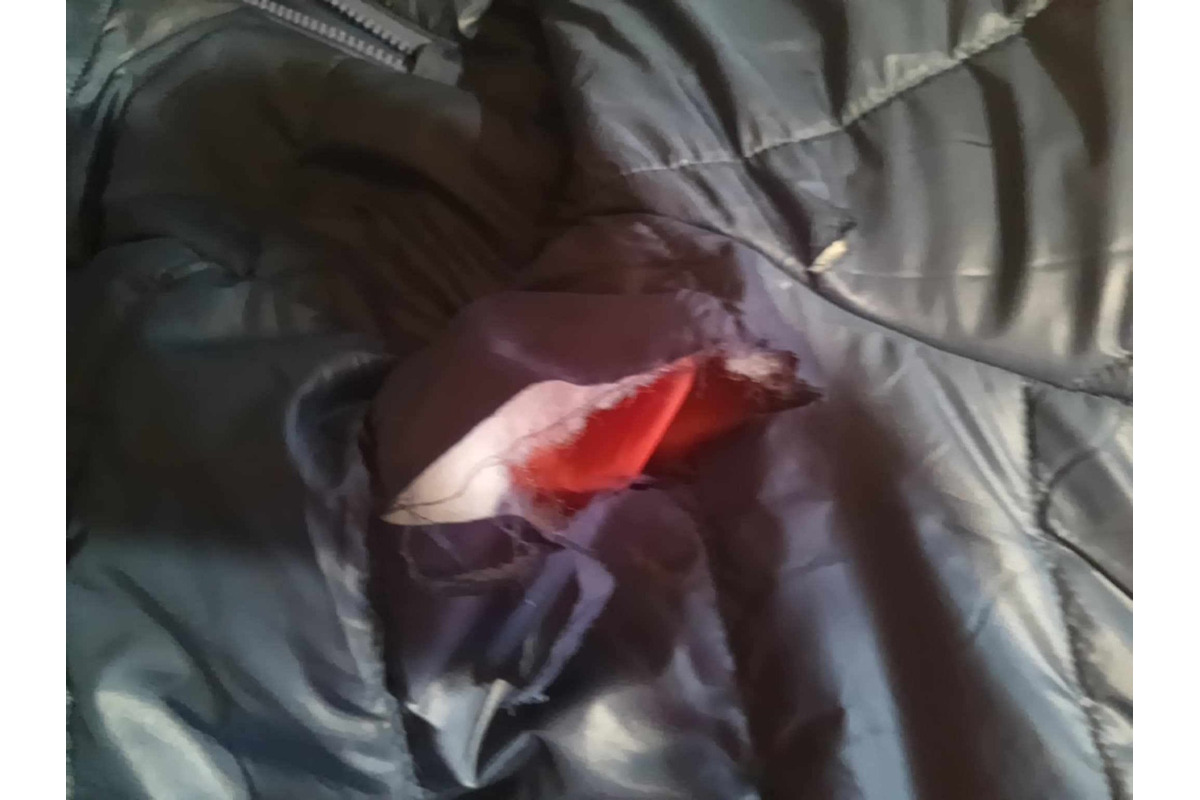 FOTO: Na seniora z Rožňavy zaútočil pes, foto 4