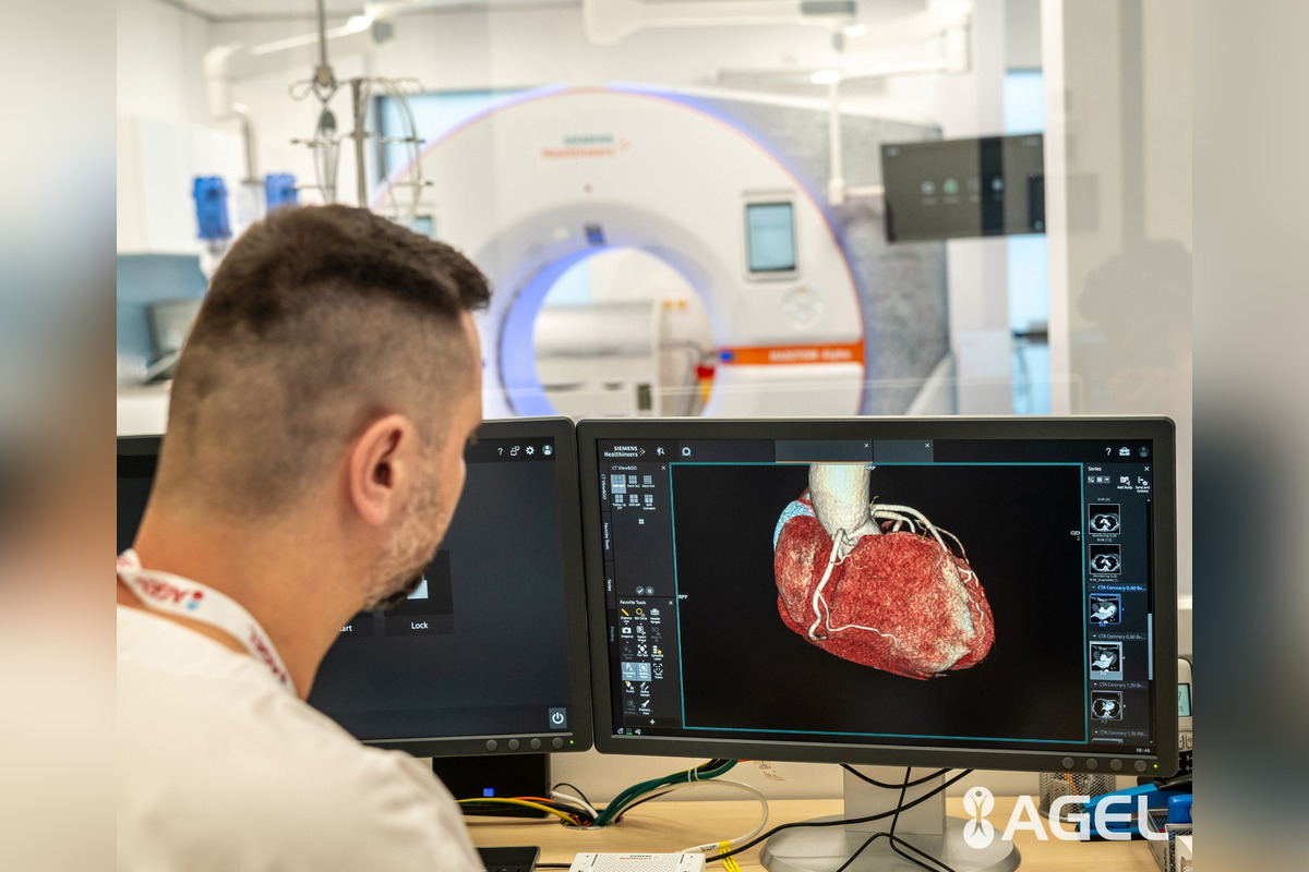 FOTO: Unikátne fotónové CT v Nemocnici Agel Košice - Šaca, foto 5