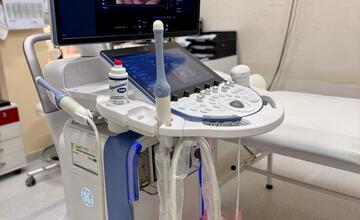 FOTO: Šačianska nemocnica predstavila najmodernejší ultrazvuk