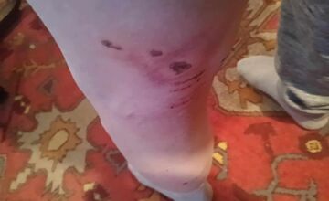 FOTO: Na seniora z Rožňavy zaútočil pes