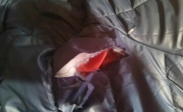 FOTO: Na seniora z Rožňavy zaútočil pes