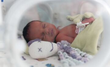 FOTO: V Košickej UNLP sa narodili trojičky